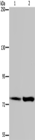 GAB2 Polyclonal Antibody – Figure 1 of 4