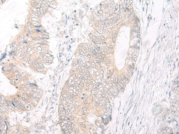 IL17A Polyclonal Antibody – Figure 1 of 2