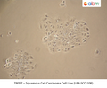Squamous Cell Carcinoma Cell Line (UM-SCC-108) | Applied Biological Materials (abm)