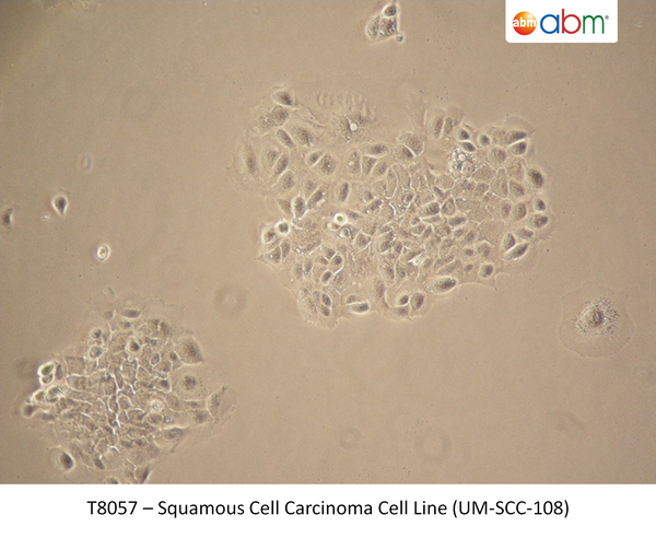 Squamous Cell Carcinoma Cell Line (UM-SCC-108) | Applied Biological Materials (abm)