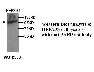 Anti-PARP1 Antibody – Figure 1 of 1