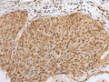 ZNF354A Polyclonal Antibody – Figure 1 of 3