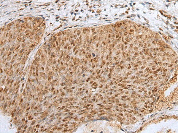 ZNF354A Polyclonal Antibody – Figure 1 of 3