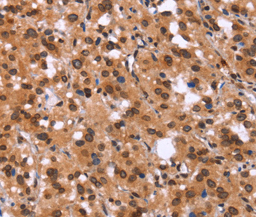 GPR124 Polyclonal Antibody – Figure 1 of 3