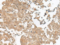 GRASP Polyclonal Antibody – Figure 1 of 3