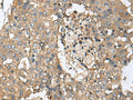 CD59 Polyclonal Antibody – Figure 1 of 2