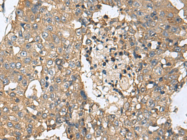 CD59 Polyclonal Antibody – Figure 1 of 2