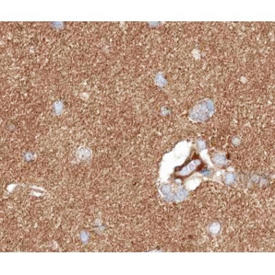 GABBR1 Antibody – Figure 1 of 6