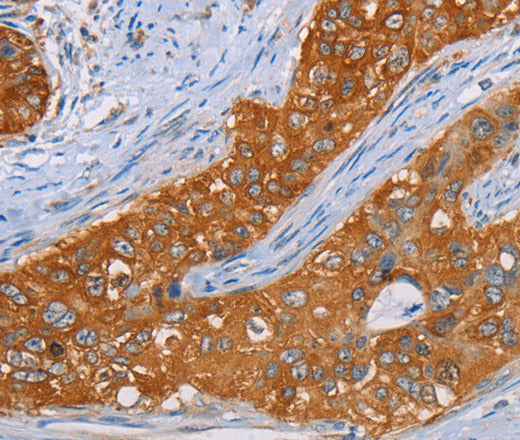 MMP1 Polyclonal Antibody – Figure 1 of 3