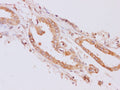 RAB5A Polyclonal Antibody – Figure 1 of 3