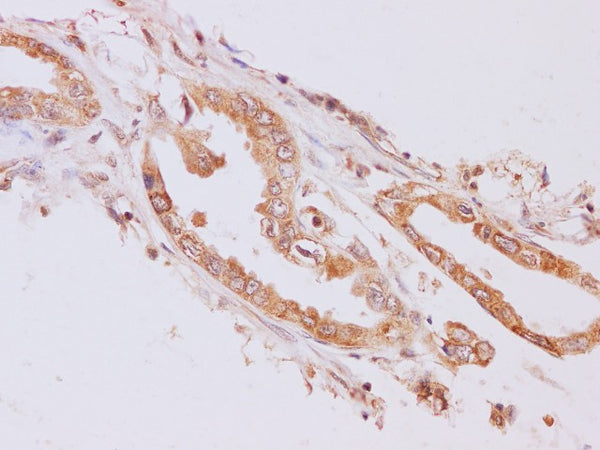 RAB5A Polyclonal Antibody – Figure 1 of 3
