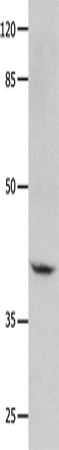 GNA11 Polyclonal Antibody – Figure 1 of 4
