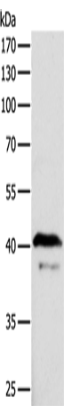 ADAP1 Polyclonal Antibody – Figure 1 of 4
