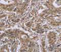 IPO8 Polyclonal Antibody – Figure 1 of 3