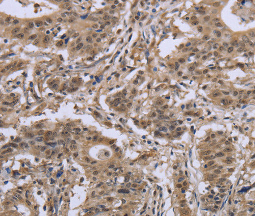IPO8 Polyclonal Antibody – Figure 1 of 3