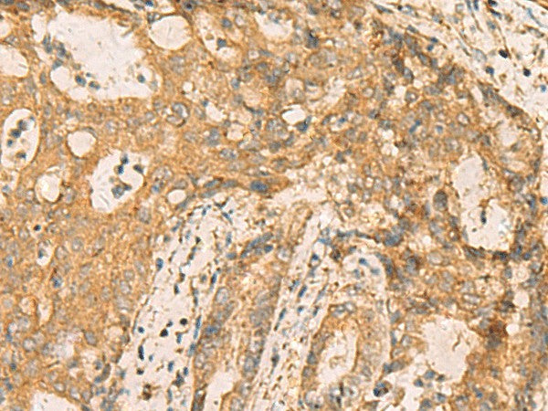 CNST Polyclonal Antibody – Figure 1 of 3