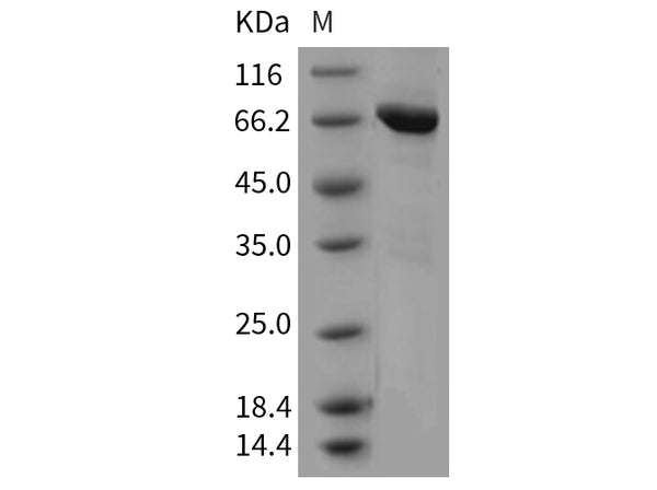 Recombinant Mouse Tie2/CD202b Protein (aa 770-1122, His & GST Tag) – Figure 1 of 2
