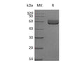 Recombinant Mouse HVEM/TNFRSF14 Protein (Fc Tag) – Figure 1 of 2