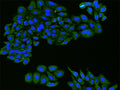 FLT1 Polyclonal Antibody – Figure 1 of 2