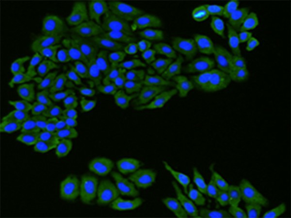 FLT1 Polyclonal Antibody – Figure 1 of 2