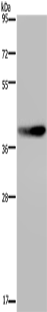 MKP-2 Polyclonal Antibody – Figure 1 of 3