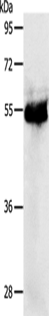 PRKAR1B Polyclonal Antibody – Figure 1 of 4