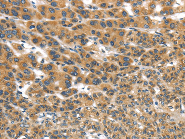 UBTD2 Polyclonal Antibody – Figure 1 of 3