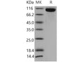 Recombinant Mouse TLR3/CD283 Protein (His Tag) – Figure 1 of 2