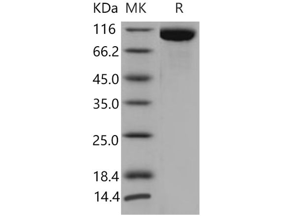 Recombinant Mouse TLR3/CD283 Protein (His Tag) – Figure 1 of 2