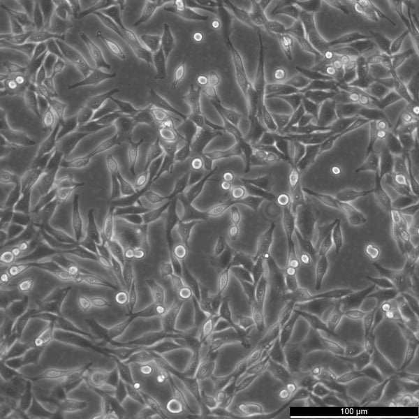 9L/lacZ cell