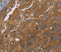 ADAMTS15 Polyclonal Antibody – Figure 1 of 3