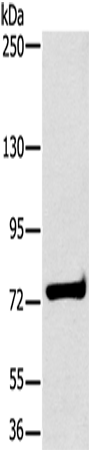 HSD17B4 Polyclonal Antibody – Figure 1 of 4