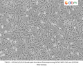 EIF2AK1/2/3/4 Quadruple Knockout Overexpressing GCN2 MEF Cell Line (EIF2AK 4KO+GCN2) | Applied Biological Materials (abm)