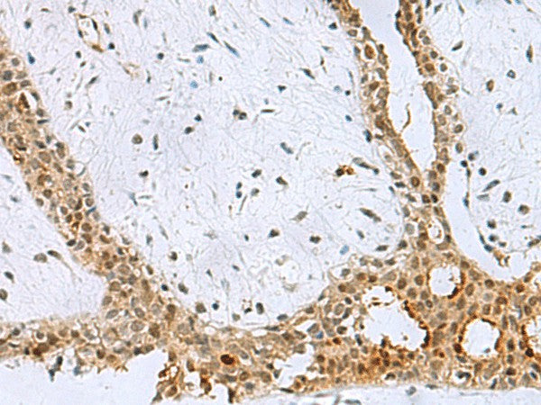 BCL7B Polyclonal Antibody – Figure 1 of 3