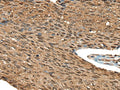 CALML5 Polyclonal Antibody – Figure 1 of 3