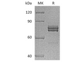 Recombinant Human CTGF/CCN2 Protein (Fc Tag) – Figure 1 of 2