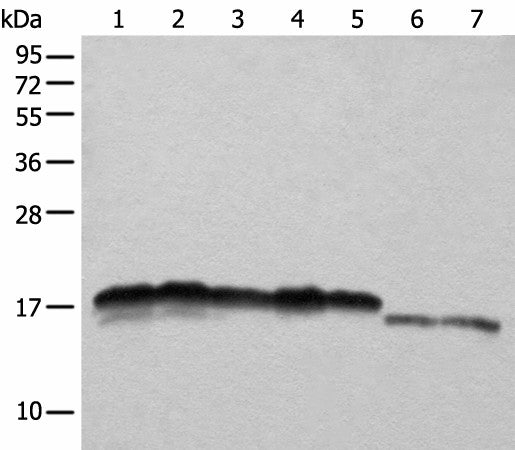NDUFB11 Polyclonal Antibody – Figure 1 of 2