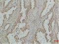 Mono-Methyl-P53 (Lys370) Monoclonal Antibody – Figure 1 of 2