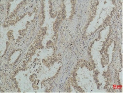 Mono-Methyl-P53 (Lys370) Monoclonal Antibody – Figure 1 of 2