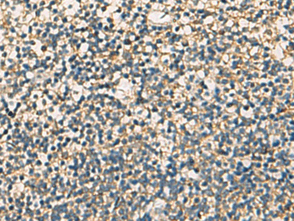 STX6 Polyclonal Antibody – Figure 1 of 3