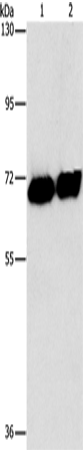 Placental Alkaline Phosphatase Polyclonal Antibody – Figure 1 of 4