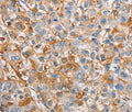 IKK gamma Polyclonal Antibody – Figure 1 of 2