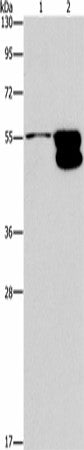 CRHR2 Polyclonal Antibody – Figure 1 of 2