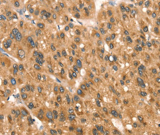 DAP Polyclonal Antibody – Figure 1 of 3