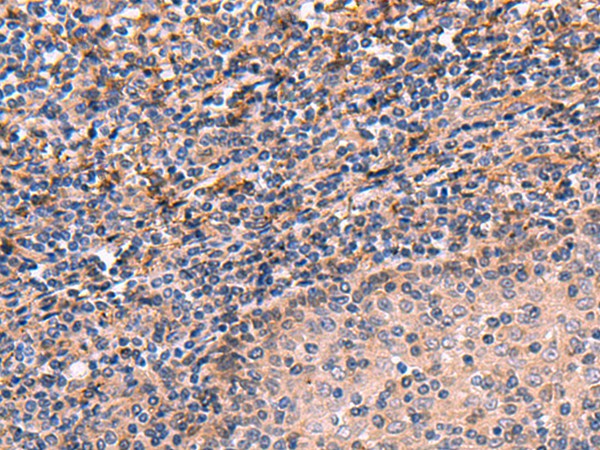 ARIH2 Polyclonal Antibody – Figure 1 of 2