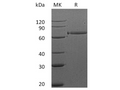 Recombinant Human HER3/ErbB3 Protein (Fc Tag) – Figure 1 of 2