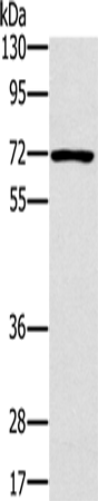 PLS3 Polyclonal Antibody – Figure 1 of 4