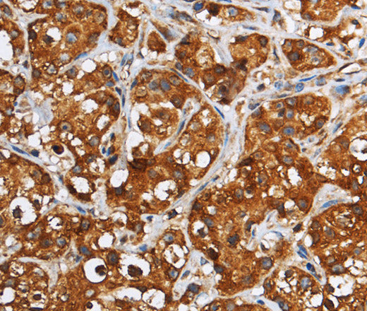 GGCX Polyclonal Antibody – Figure 1 of 3
