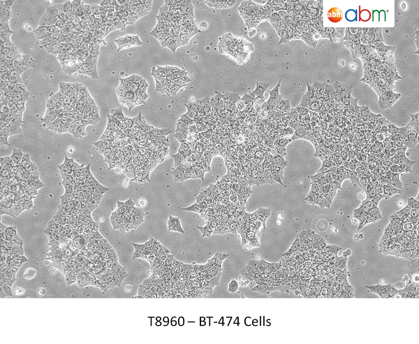 BT-474 Cells – Figure 1 of 1