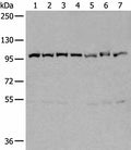 VCP Polyclonal Antibody – Figure 1 of 4